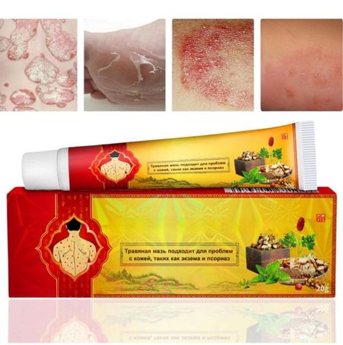 3pcs Antifungal Cream,Cream for Itchy Skin,Antifungal Cream for Skin,Itchy Skin