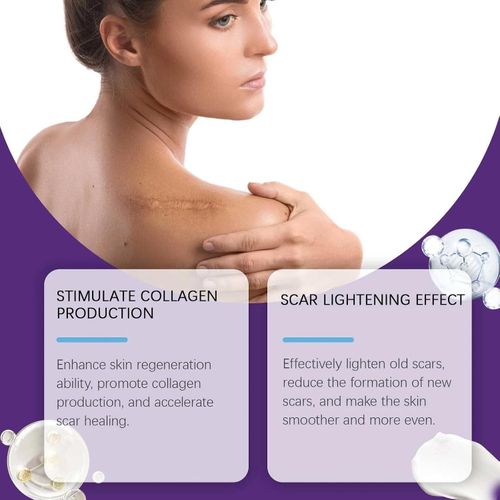 Silicone Scar Gel - Advanced Treatment for Old & New Scars, C-Section, Surgery, — image 5