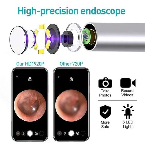 Wireless Ear Wax Removal Camera | HD Ear Endoscope Ear Cleaning Tool with Camera — image 7