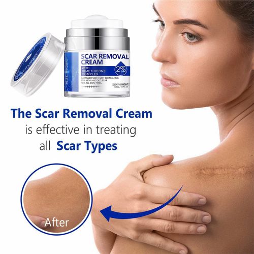 Scar Removal Cream - Rapid Repair of New & Old Scars, Acne Spots, Burns — image 7