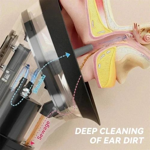 Electric Ear Wax Removal System Water Irrigation Cleaner 3 Pressure Settings — image 4