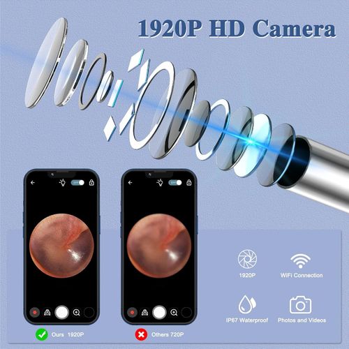 Ear Wax Removal Kit Ear Camera1080P High-Definition Earwax Cleaner ,App Control — image 3