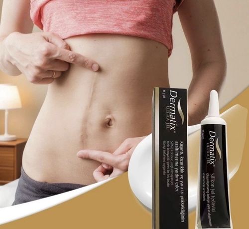 2packs of Dermatix Silicone Scar Treatment Gel Advanced Silcione Scar. 15g — image 4
