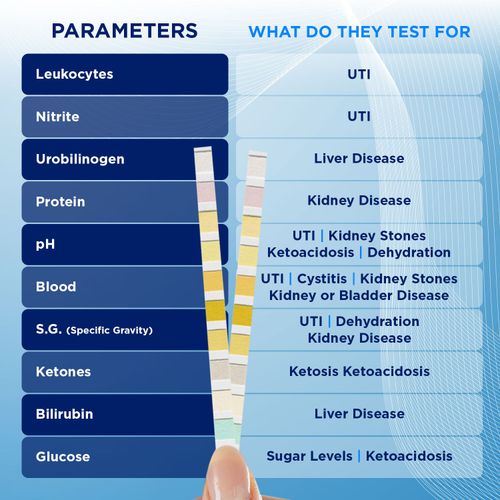 25 Urine Test Strips 10 Parameter Urinalysis Professional GP Sticks(5x5 Pack) — image 3