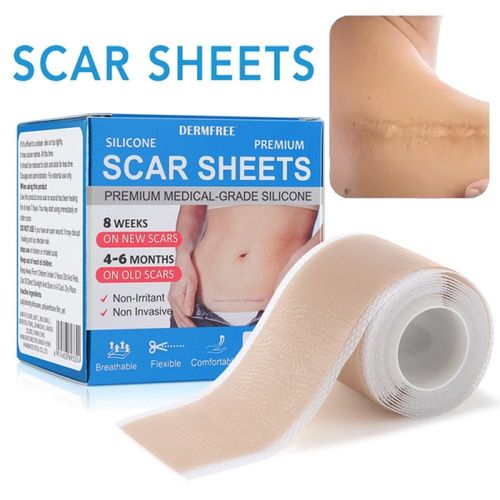 4cm*1.5m Medical Grade Scar Removal Tape Silicone Scar Sheets Treatment Patches