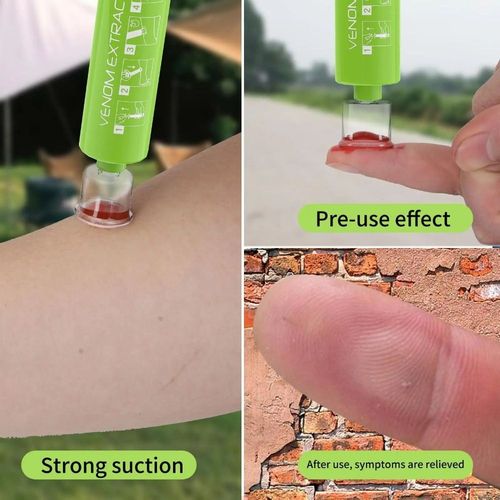 Bug Bite Suction Tool Bite Venom Extractor Insect Sting Sucker Outdoor Tools — image 5