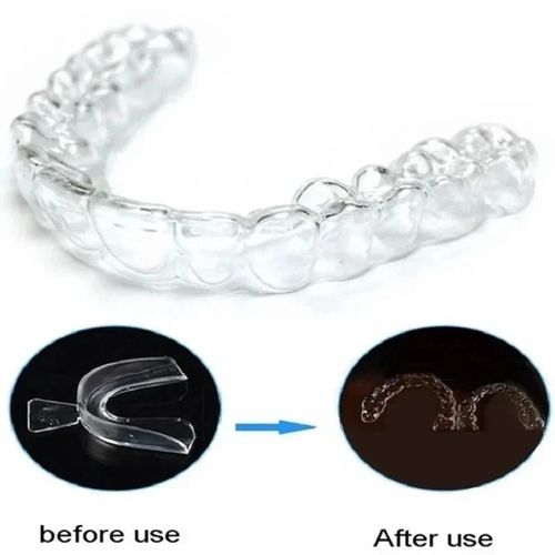 4x Mouth Guard Teeth Grinding Dental Night Guard Custom Fit Bruxism Sleep Aid UK — image 3