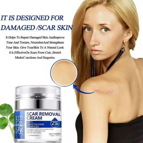 Scar Removal Cream Skin Repair Cream for Old and New Scars Scar Treatment Gel — image 5
