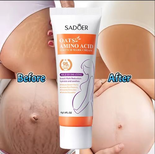 stretch- marks removal cream Skin Repair Pregnancy Belly Spots Removal Cream — image 2
