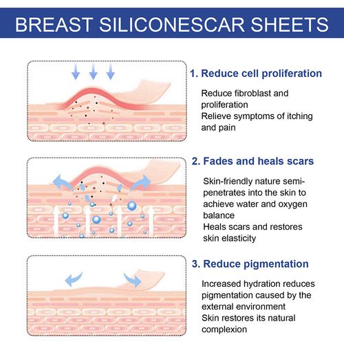 Silicone Scar Sheets for Breast Scar Removal Sheets Areola Strips Anchor Sheets — image 4