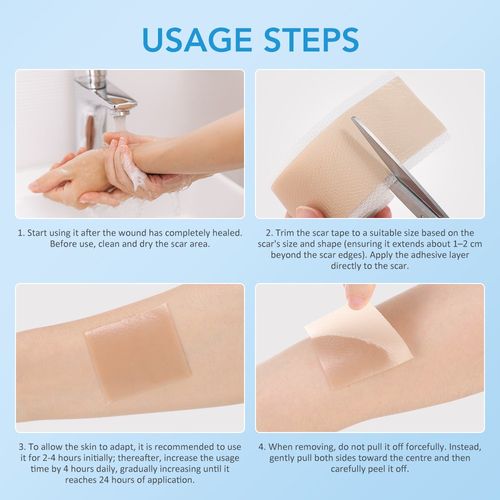 4cm*1.5m Medical Grade Scar Removal Tape Silicone Scar Sheets Treatment Patches