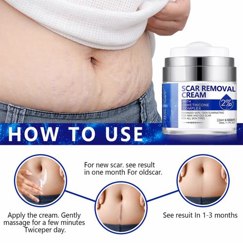 Scar Removal Cream - Rapid Repair of New & Old Scars, Acne Spots, Burns — image 4