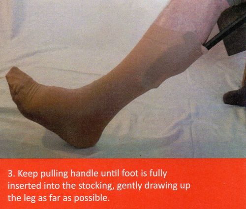COMPRESSION STOCKING and SOCK AID Easy On/Off - SOXONOFF DOES THE JOB  — image 9