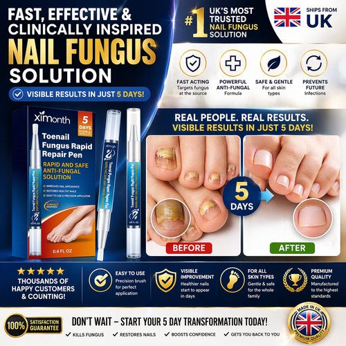 Nail Care Pen, 4Pcs Fungal Nail Pen, Nail Fungus Treatment for Toenail UK