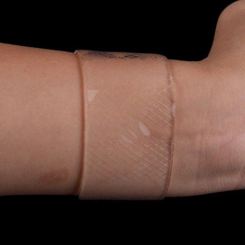 Silicone Gel Sheet Scar Treatment Repair Keloid Cesarean Away Wound Removal ZS — image 5