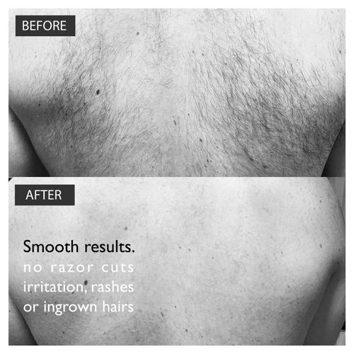Men's Back Hair Removal Kit Depilatory Cream Self Groomer Tool Baldape Parlour — image 4