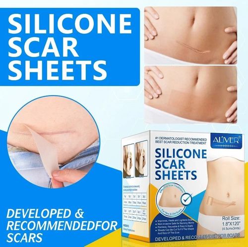 Silicone Scar Sheet MEDICAL GRADE Scar Removal Silicone Tape Treatment