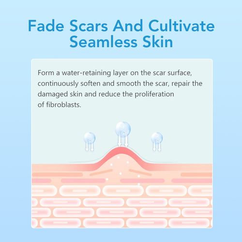 150cm Silicone Scar Tape Scar Sheets Tape Roll For Sensitive Skin Face Wrinkle — image 14