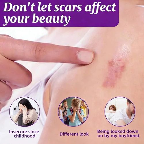 Silicone Scar Gel - Advanced Treatment for Old & New Scars, C-Section, Surgery, — image 3
