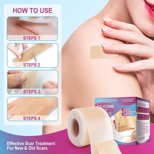 VOGSIG Silicone Scar Sheets Size 1.6"X75" Ultra-Thin Breathable & Waterproof — image 4