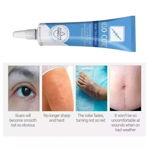15gSilikongel zur Behandlung von alten und neuen Narben，Scar Treatment UK NEW — image 7