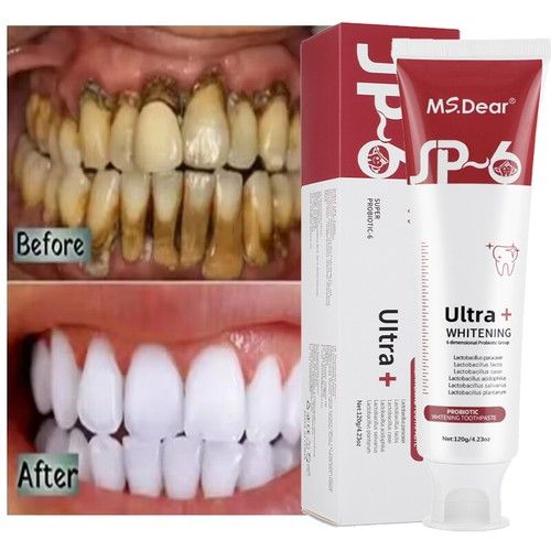 SP-6 Probiotic Toothpaste, SP-6 Toothpaste Ultra Whitening Quick Fresh Breath UK