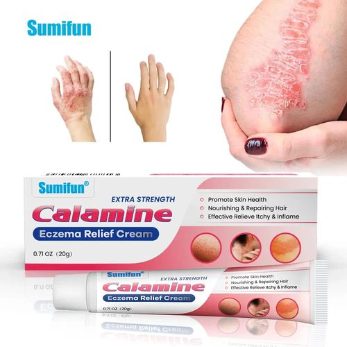 New 20g Rosacea Ointment Treat Red Nose Acne Cream Pimple Scar Repair Skin Care — image 16