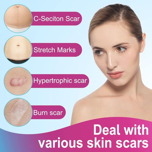VOGSIG Silicone Scar Sheets Size 1.6"X75" Ultra-Thin Breathable & Waterproof — image 3