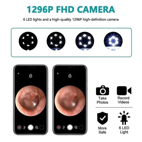 Wireless Ear Wax Removal Camera | HD Ear Endoscope Ear Cleaning Tool with Camera — image 5