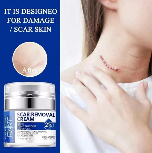 Scar Removal Cream Skin Repair Cream for Old and New Scars Scar Treatment Gel — image 4