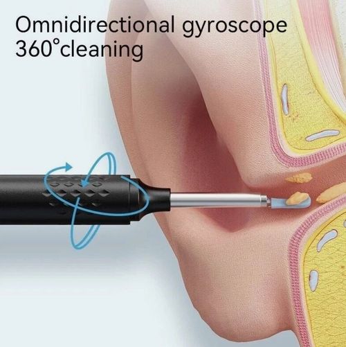 Wireless Ear Wax Removal Camera | HD Ear Endoscope Ear Cleaning Tool with Camera — image 10