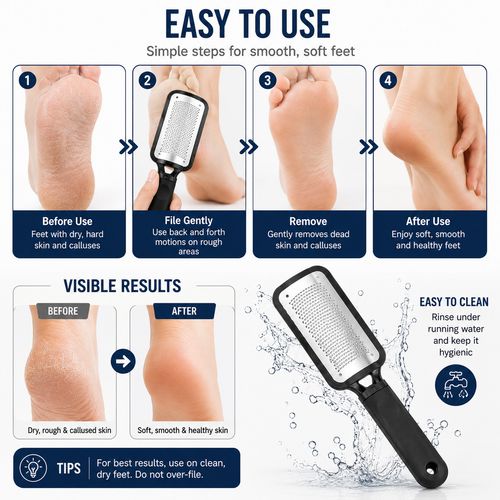 Foot Rasp File Callus Remover Hard Dead Skin Pedicure Foot Care Tool UK Seller — image 3