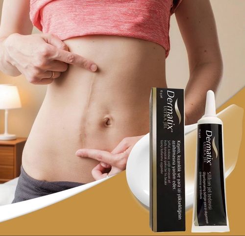 Dermatix 15g Silicone Scar Treatment Gel Advanced Silcione Scar. Fast Delivery — image 5
