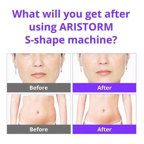 4 in 1 Beauty Machine for Body Massage Facial Skin Care Skin Lifting S-Shape8 — image 10