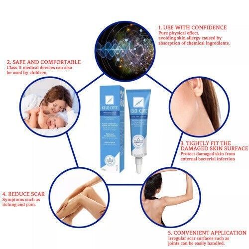15gSilikongel zur Behandlung von alten und neuen Narben，Scar Treatment UK NEW — image 4
