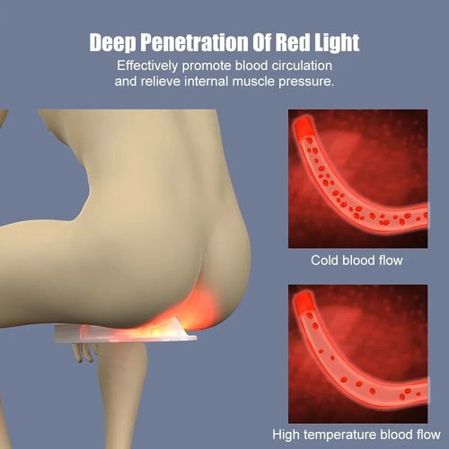 Hemorrhoid Hemorrhoids Treatment Device Hemorrhoid Removal Red Light Therapy — image 2