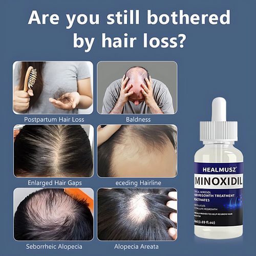 10 Month Supply Men Women Hair Regrowth Treatment Extra Strength Solution 50ml — image 15