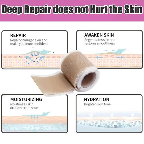 Silicone Scar Sheet MEDICAL GRADE Scar Removal Silicone Tape Treatment