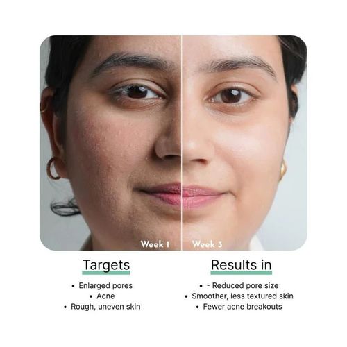 Cos-IQ B3-5% Niacinamide Face Serum for Clear Glowing Skin 30ml — image 6