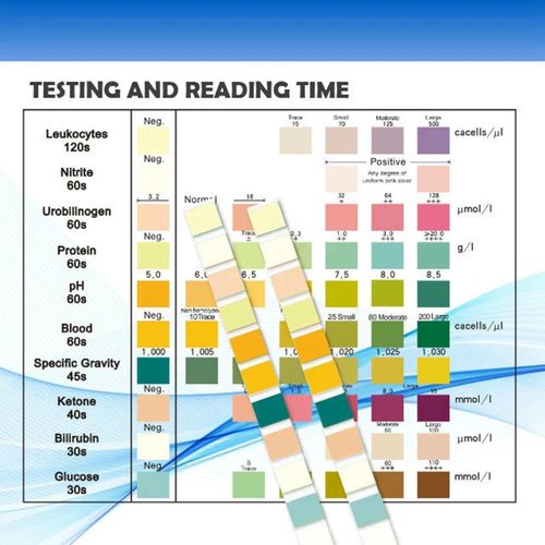 100 Strips Urine Test Strip 10 Parameters Urinalysis Dip-Stick PH Test Strips uk — image 4
