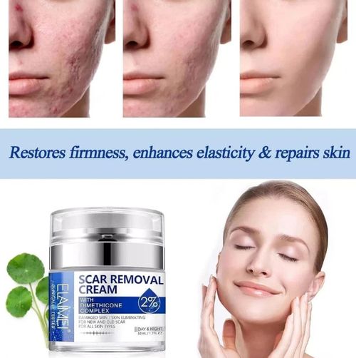 Scar Removal Cream Skin Repair Cream for Old and New Scars Scar Treatment Gel — image 6