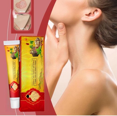 3pcs Antifungal Cream,Cream for Itchy Skin,Antifungal Cream for Skin,Itchy Skin — image 9
