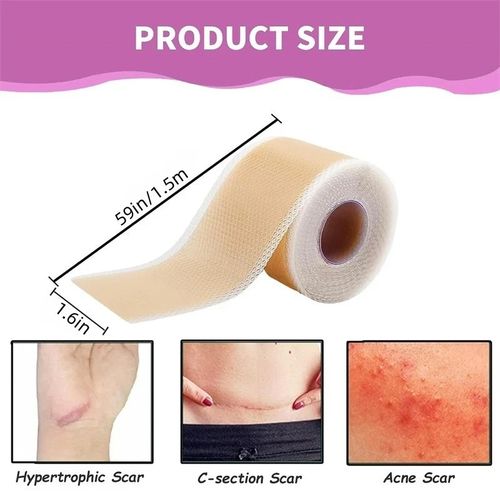 Silicone Scar Sheet MEDICAL GRADE Scar Removal Silicone Tape Treatment
