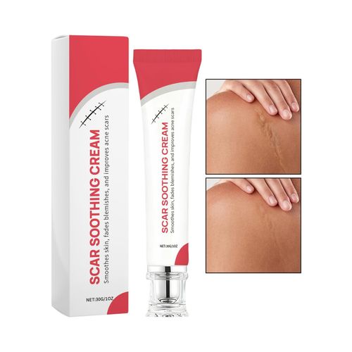 Scar Soothing Cream Scar Gentle Non-Greasy Soothing & Smoothing Skin Cream 30g