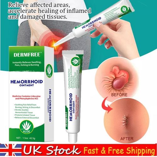 Hemorrhoid Cream Haemorrhoids Fissure Gel Piles Anal Fissure Prolapse Ointment — image 1