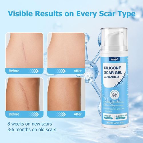 Clinically Proven Silicone Scar Gel 50ML - Smooths & Repairs Scars for All Skin — image 7