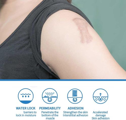 Silicone Scar Gel - 50ml Cream for Effective Scar Removal & Skin Soothing — image 6